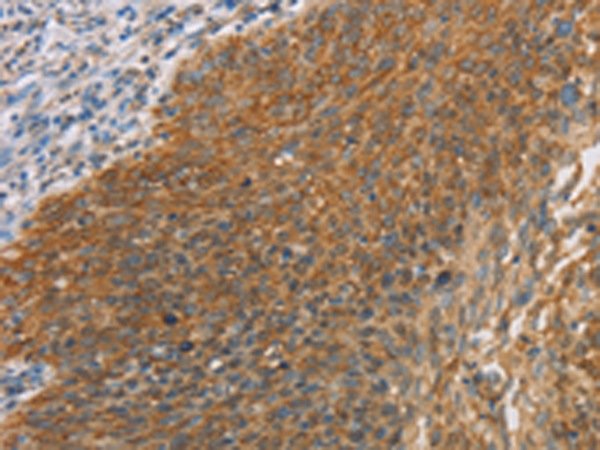 Rabbit Polyclonal Antibody to MAPK6