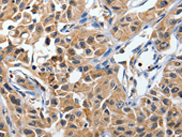 Rabbit Polyclonal Antibody to DUSP8