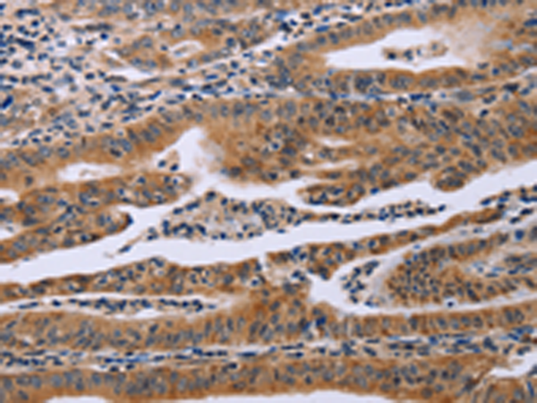 Rabbit Polyclonal Antibody to FAF1