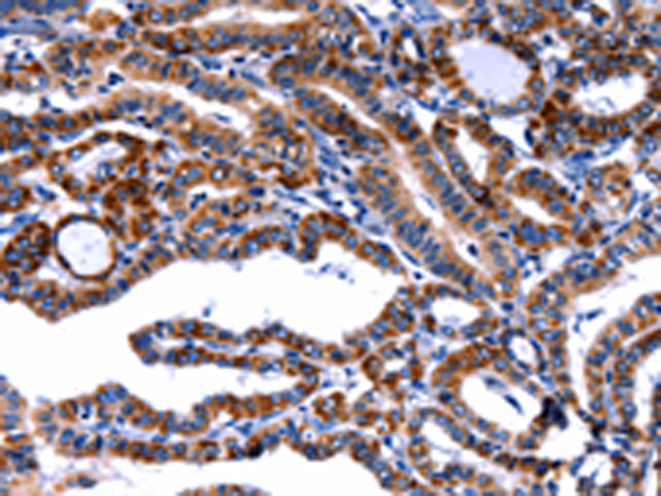 Rabbit Polyclonal Antibody to FBN1