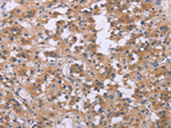Rabbit Polyclonal Antibody to FGFR2