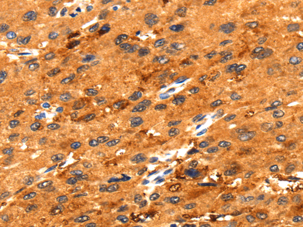 Rabbit Polyclonal Antibody to FGFR3
