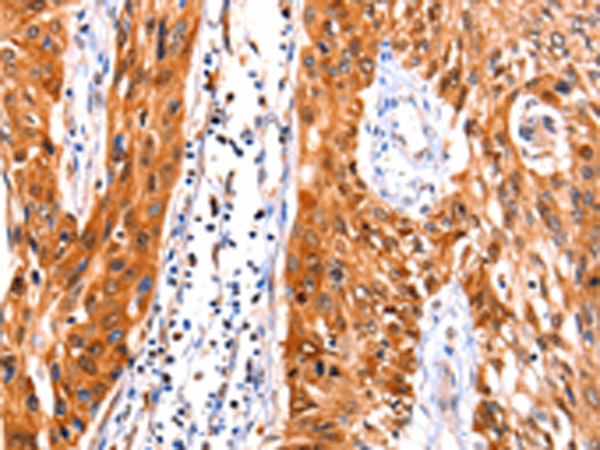 Rabbit Polyclonal Antibody to FBLN1