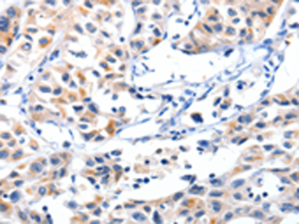 Rabbit Polyclonal Antibody to FBLN5