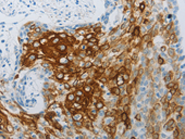 Rabbit Polyclonal Antibody to FLG