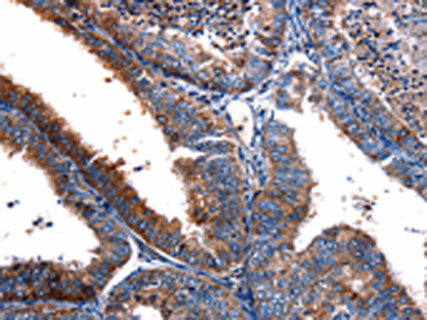 Rabbit Polyclonal Antibody to FPR2