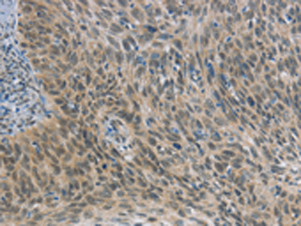 Rabbit Polyclonal Antibody to FOXF1