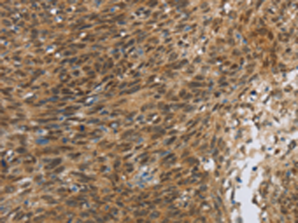 Rabbit Polyclonal Antibody to FOXB1
