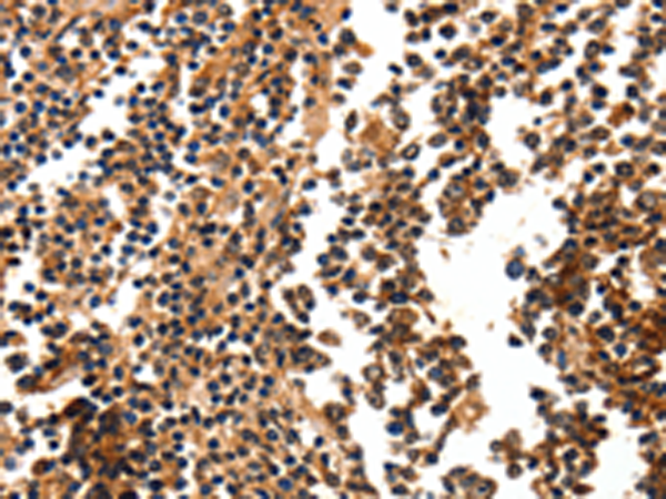 Rabbit Polyclonal Antibody to FOXB2