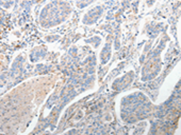 Rabbit Polyclonal Antibody to FOXD1