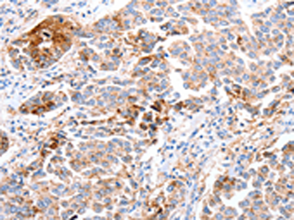 Rabbit Polyclonal Antibody to FOXD2