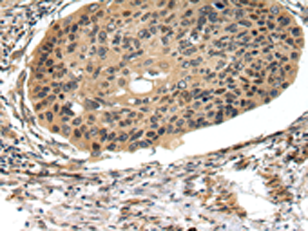 Rabbit Polyclonal Antibody to FOXK1