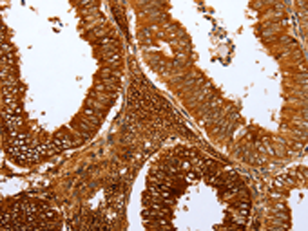 Rabbit Polyclonal Antibody to FOXN1