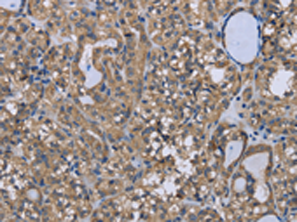 Rabbit Polyclonal Antibody to FOXO1