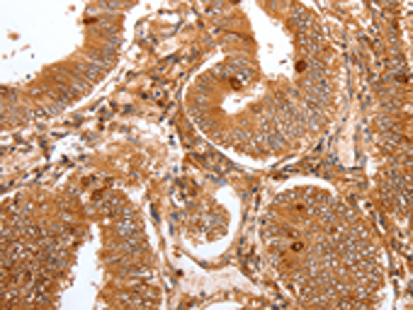 Rabbit Polyclonal Antibody to FOXO3