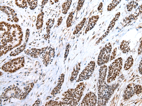 Rabbit Polyclonal Antibody to FOXP1