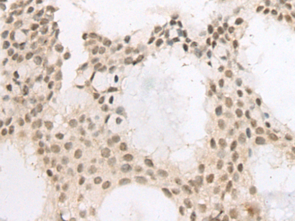 Rabbit Polyclonal Antibody to FOXP2