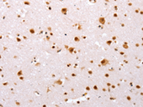 Rabbit Polyclonal Antibody to TBX2