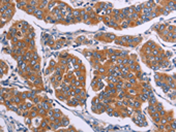 Rabbit Polyclonal Antibody to FST