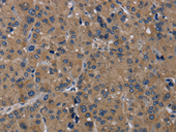Rabbit Polyclonal Antibody to TRPM1