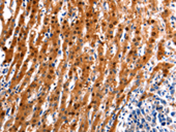 Rabbit Polyclonal Antibody to ID4