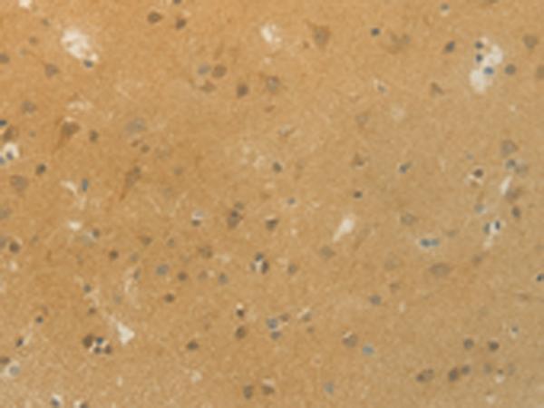 Rabbit Polyclonal Antibody to SLC9A3