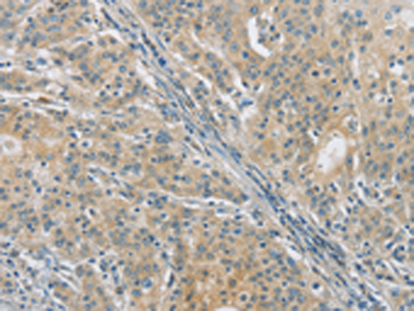 Rabbit Polyclonal Antibody to PKD1