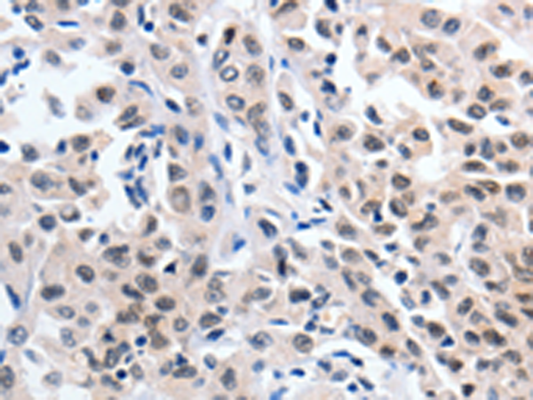 Rabbit Polyclonal Antibody to SUMO1