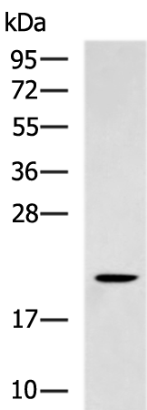 Rabbit Polyclonal Antibody to SUMO2/SUMO3/SUMO4