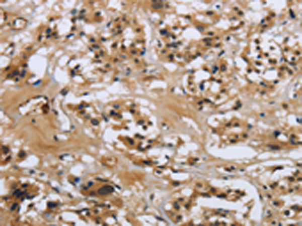 Rabbit Polyclonal Antibody to LGALS7