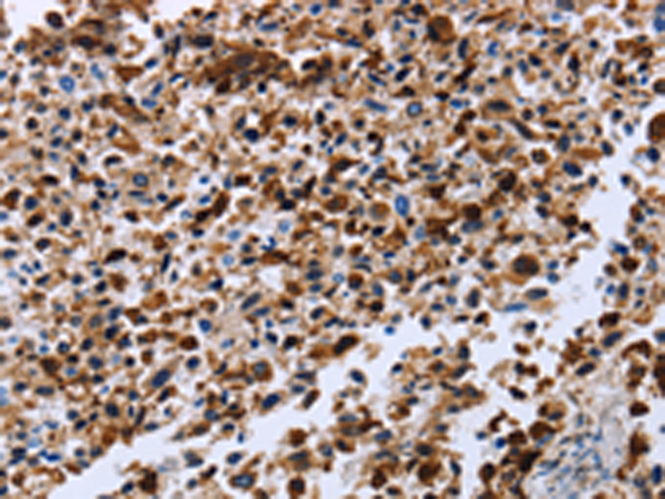 Rabbit Polyclonal Antibody to CXCR3