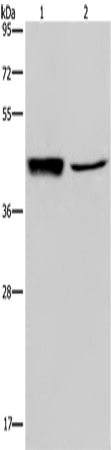 Rabbit Polyclonal Antibody to GRPR