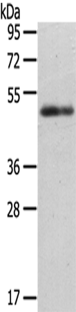 Rabbit Polyclonal Antibody to CCKBR