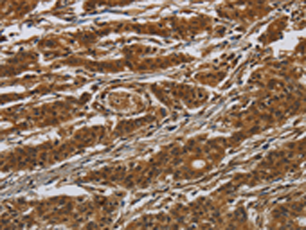 Rabbit Polyclonal Antibody to GATA5