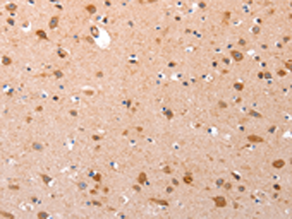 Rabbit Polyclonal Antibody to GATA6