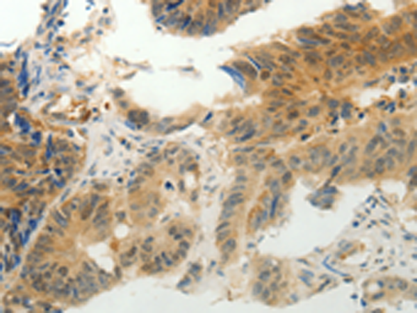 Rabbit Polyclonal Antibody to CMTM7
