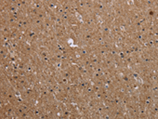 Rabbit Polyclonal Antibody to CMTM5