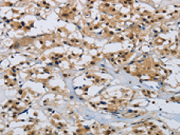 Rabbit Polyclonal Antibody to CMTM8