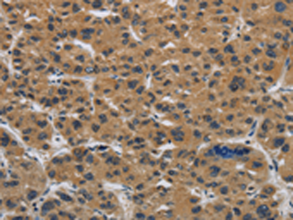 Rabbit Polyclonal Antibody to CLDN2