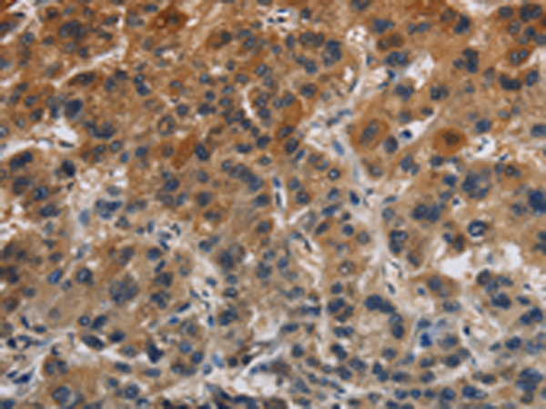 Rabbit Polyclonal Antibody to CLDN8