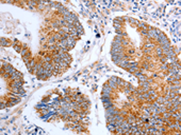 Rabbit Polyclonal Antibody to CLDN10