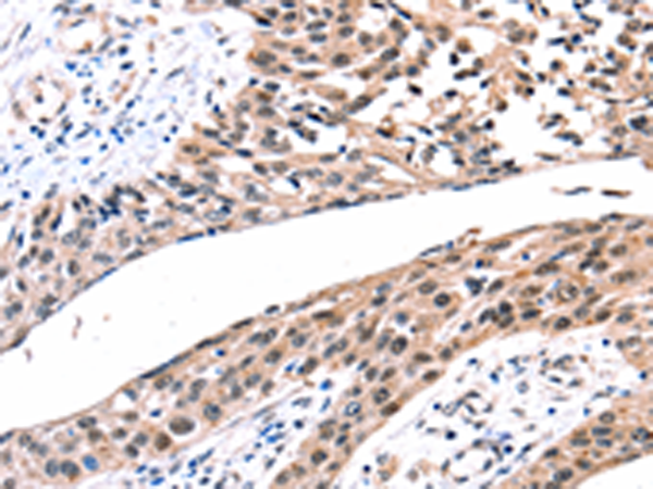 Rabbit Polyclonal Antibody to GJB2