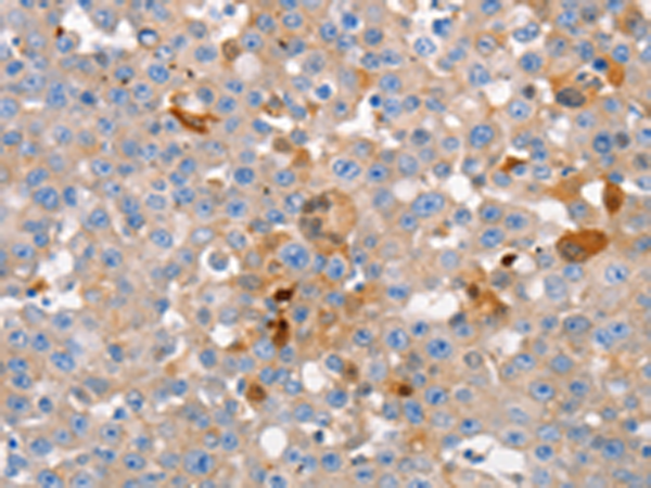Rabbit Polyclonal Antibody to GJB6