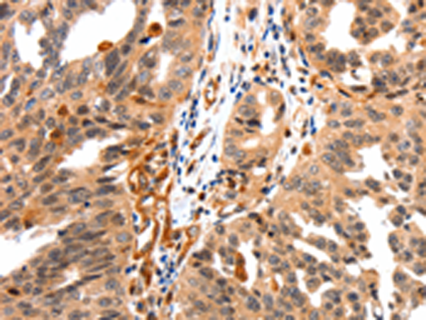 Rabbit Polyclonal Antibody to GAS6