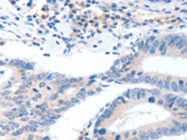Rabbit Polyclonal Antibody to GCK