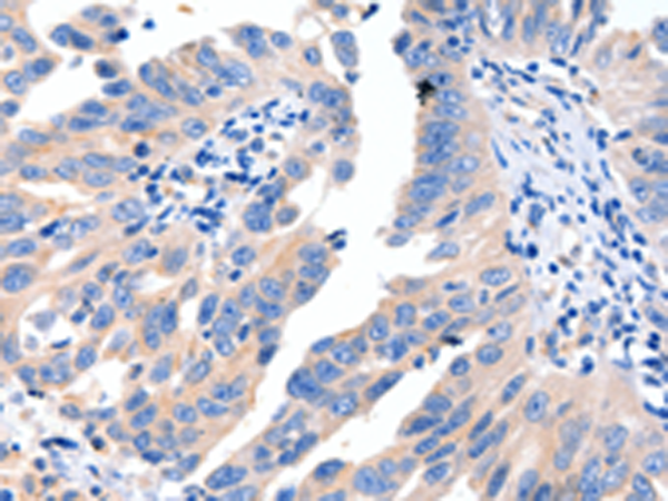 Rabbit Polyclonal Antibody to MSTN