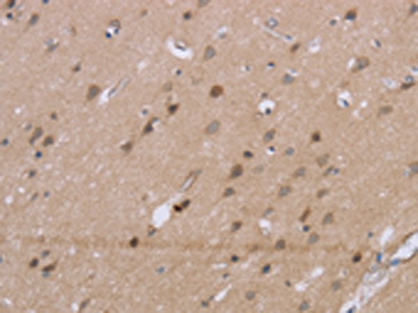 Rabbit Polyclonal Antibody to GSN