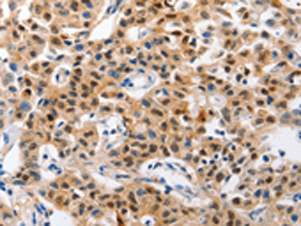 Rabbit Polyclonal Antibody to GCG(GLP1)