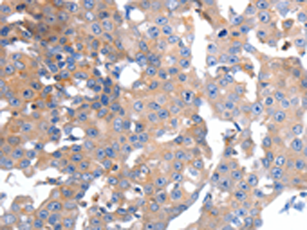 Rabbit Polyclonal Antibody to GCG