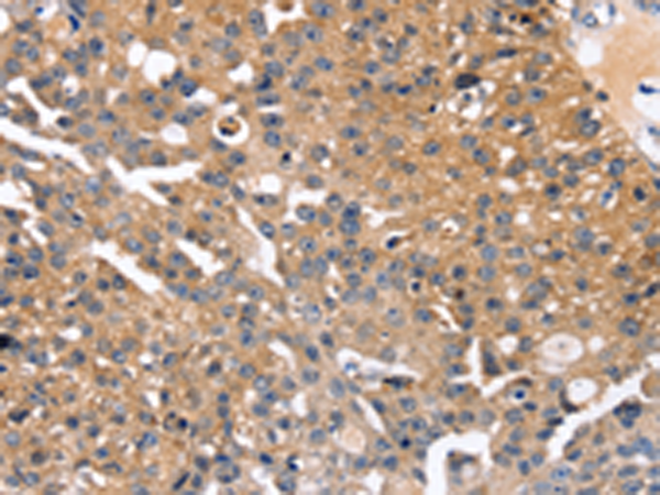 Rabbit Polyclonal Antibody to SLC2A2
